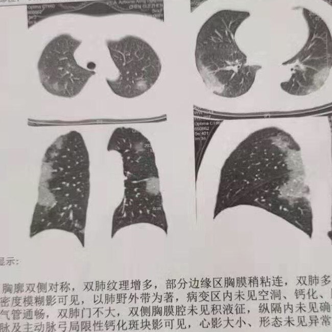 圖片1